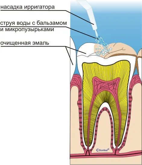 Этапы гигиены полости рта. Этапы профессиональной гигиены. Этапы проф гигиены полости рта. Профессиональная чистка зубов этапы. Перечислите этапы профессиональной гигиены полости рта.