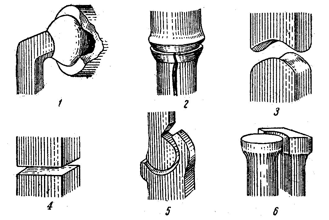 Какой сустав изображен. Седловидный и шаровидный суставы. Цилиндрический и блоковидный сустав. Блоковидный сустав оси. Мыщелковый сустав схема.