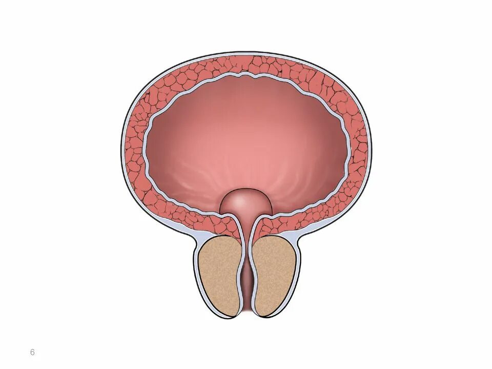 Ткани простаты. Простата. Аденома. Мочевой пузырь..