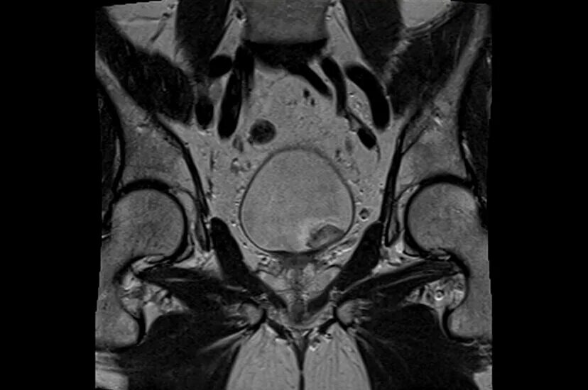 Кт органов таза у мужчин