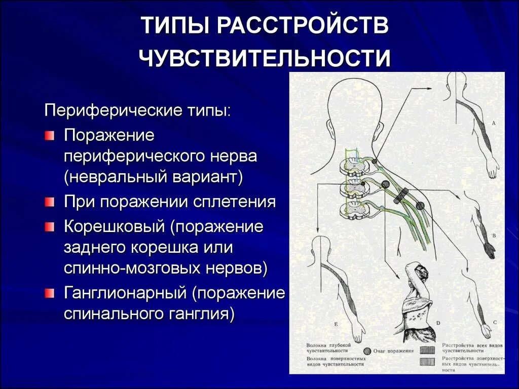 Поражение двигательного нерва. Типы расстройств чувствительности. Типы поражения чувствительности. Типы расстройств чувствительности неврология. Виды нарушения поверхностной чувствительности.