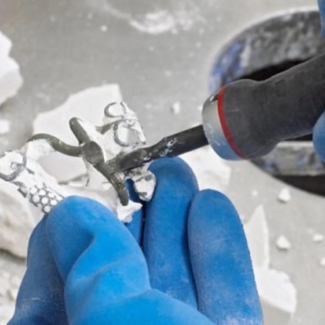 Перелом лучевой кости наложение гипса. Удаление гипса. Гипс в природе. Удаление гипса. Удаление гипса.