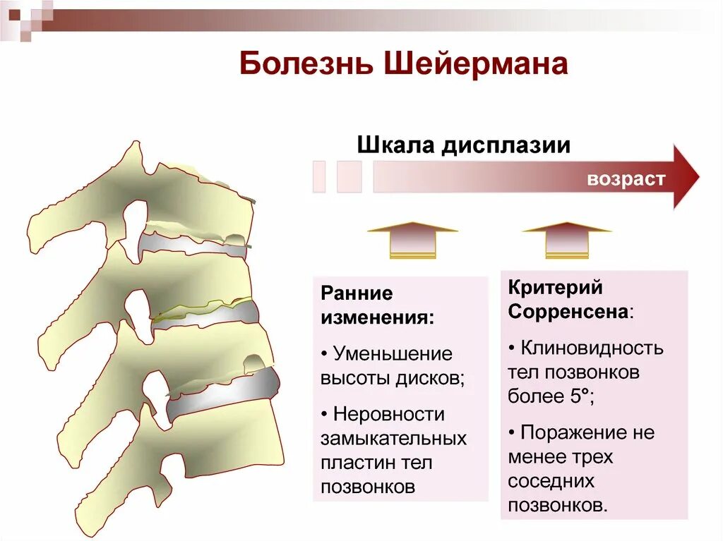 - Гиперкифоз (болезнь Шейермана-МАУ). Уплотнение замыкательных пластинок тел позвонков. Замыкательные пластинки тел позвонков на рентген. Уплотнены замыкательные пластины тел позвонков с2-с7.