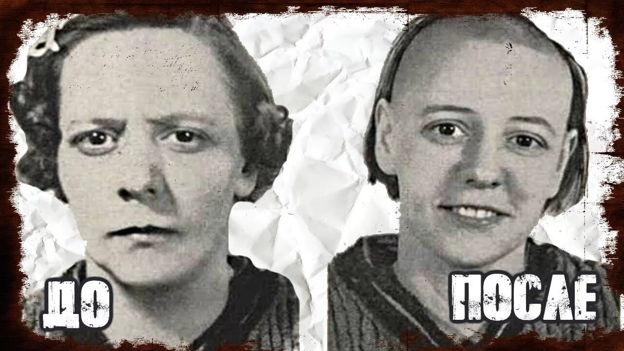 Лоботамия