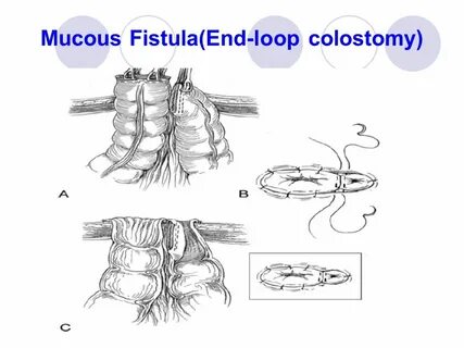 Loop end loop