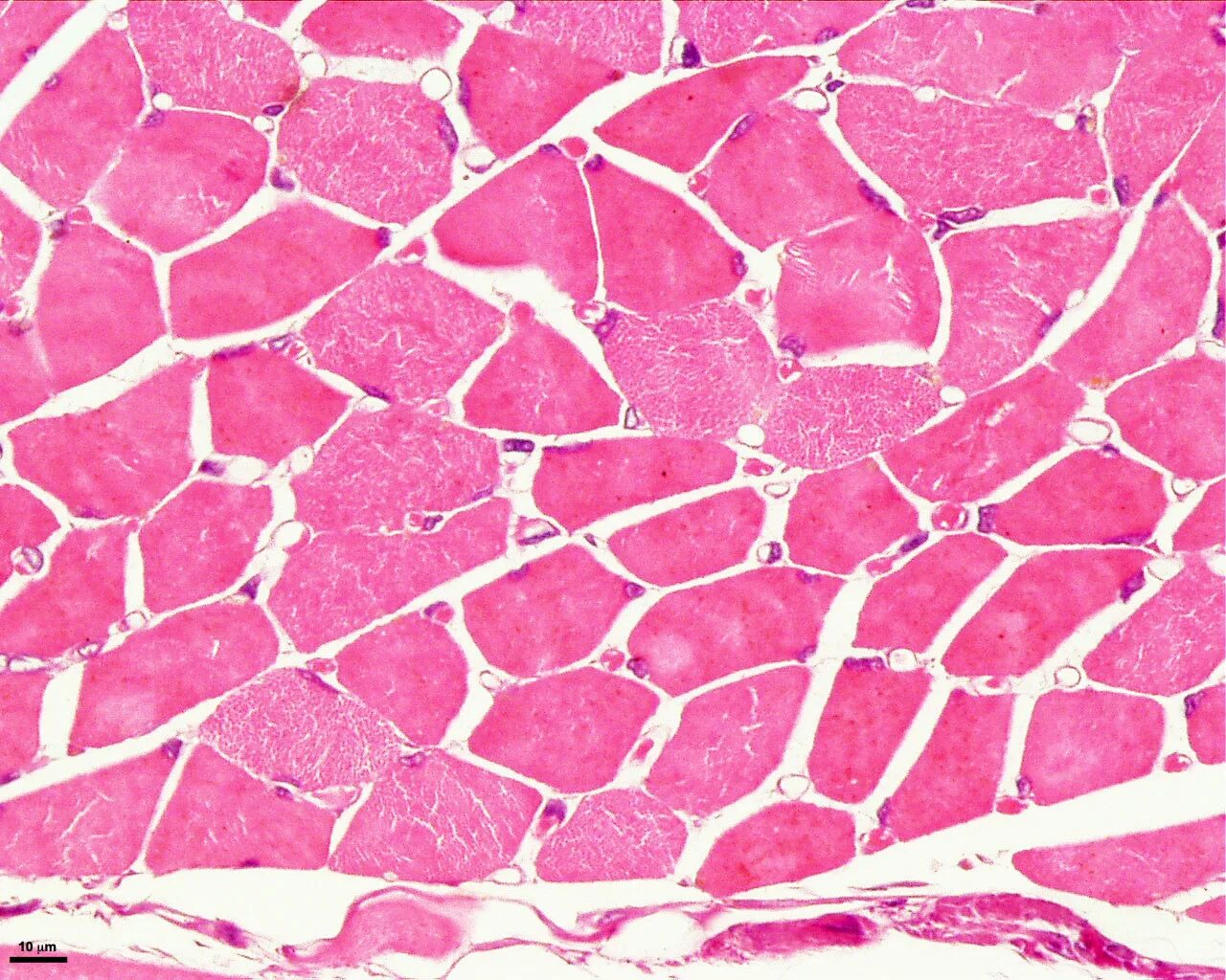 Мышечная клетка кожи. Skeletal muscle histology. мышечная ткань гистология препараты. skeletal muscle tissue. мышцы ткани гистология.