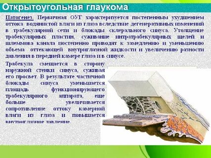 Первичная открытоугольная глаукома