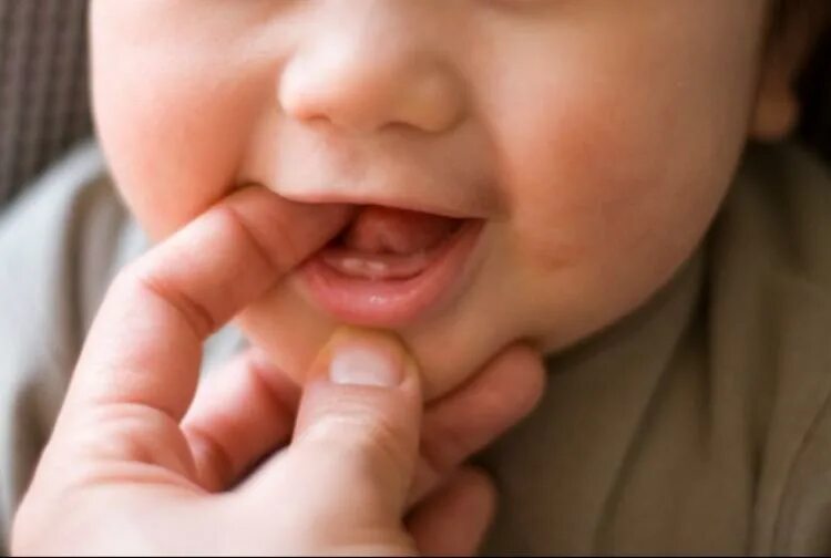 Прорезывание зубов у детей. Прорезывание первых зубов у детей. Прорезаются зубы температура