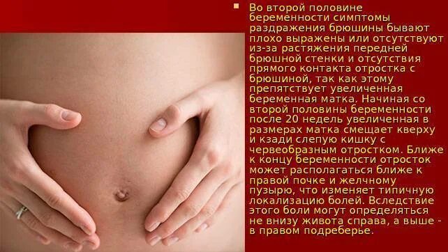 2 триместр болят почки. Аппендицит у беременных симптомы 3 триместр. аппендицит симптомы у беременных женщин во 2 триместре. расположение аппендицита у беременных. боль при аппендиците у беременных.