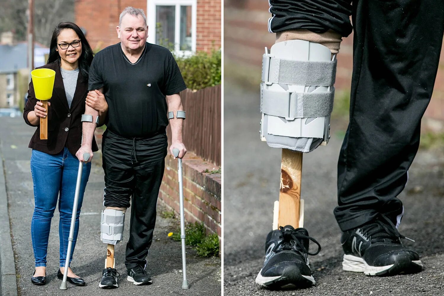 Самодельные ноги. Протез ноги. Бионический протез ноги. Современные протезы ног. Необычные протезы ног.
