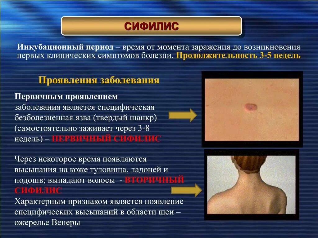 Какие заболевания заразные. Первичные проявления сифилиса. Кожные проявления сифилиса. Сифилитические проявления на коже. Венерические заболевания сифилис.