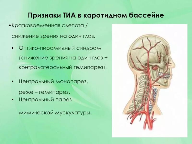 Оптико пирамидный синдром. Оптико пирамидный синдром