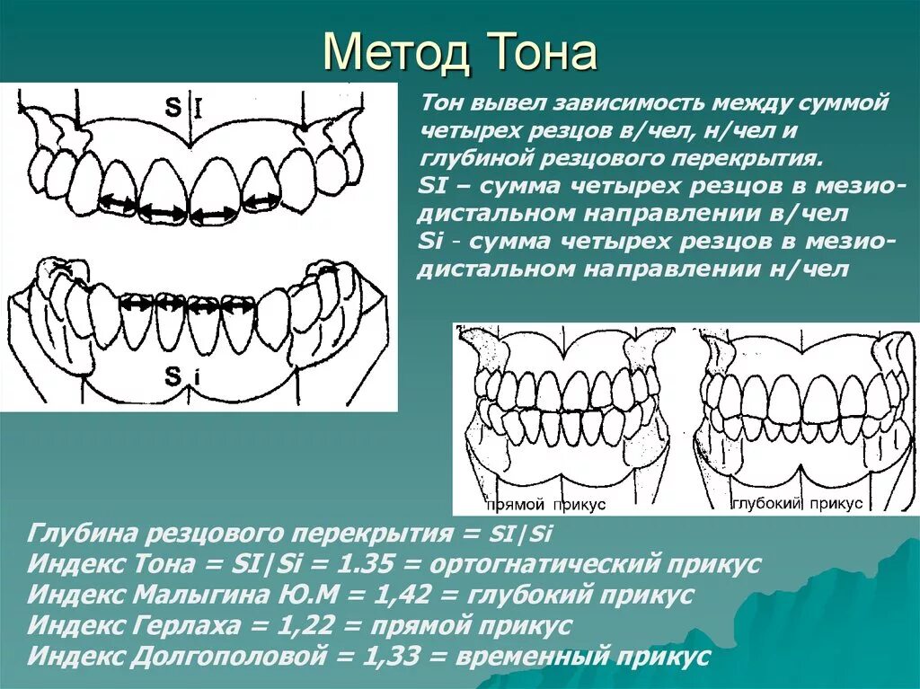 Метод кона. Метод тона ортодонтия. Индексы в ортодонтии. Метод тонна в ортодонтии. Методика пона ортодонтия.