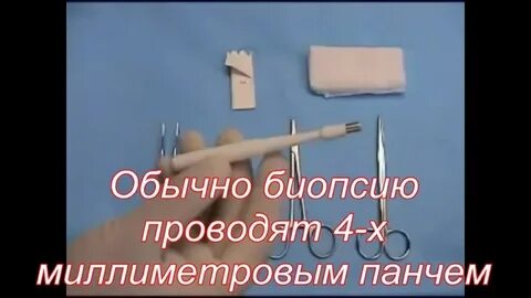 Панч биопсия кожи