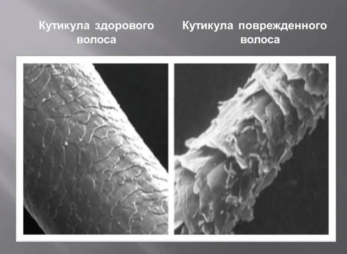 Здоровый и поврежденный волос под микроскопом. Кожа головы человека под микроскопом. Волос под микроскопом. Волосы под микроскопом после кератинового выпрямления. Здоровый волос под микроскопом.