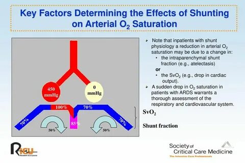 Key factor
