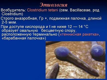 Возбудителем столбняка является