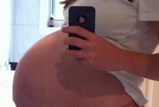 Живот на 39 неделе беременности. Каменеет живот на 39 неделе. 39 Недель беременности каменеет живот. Беременность 39 недель как ускорить