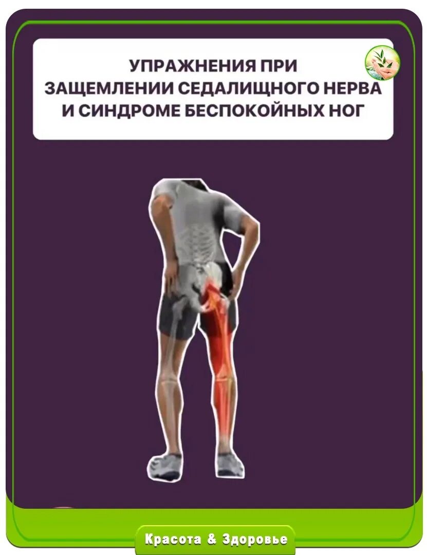От чего бывает защемление нерва. Упражнения от седалищного нерва. упражнения от защемления седалищного нерва. упражнения при воспалении седалищного нерва.