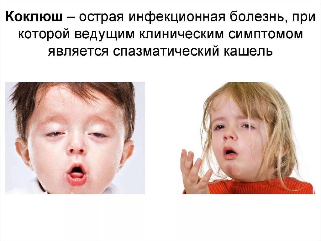 Pertussis коклюш. Коклюш восприимчивость. Коклюш симптомы репризы.