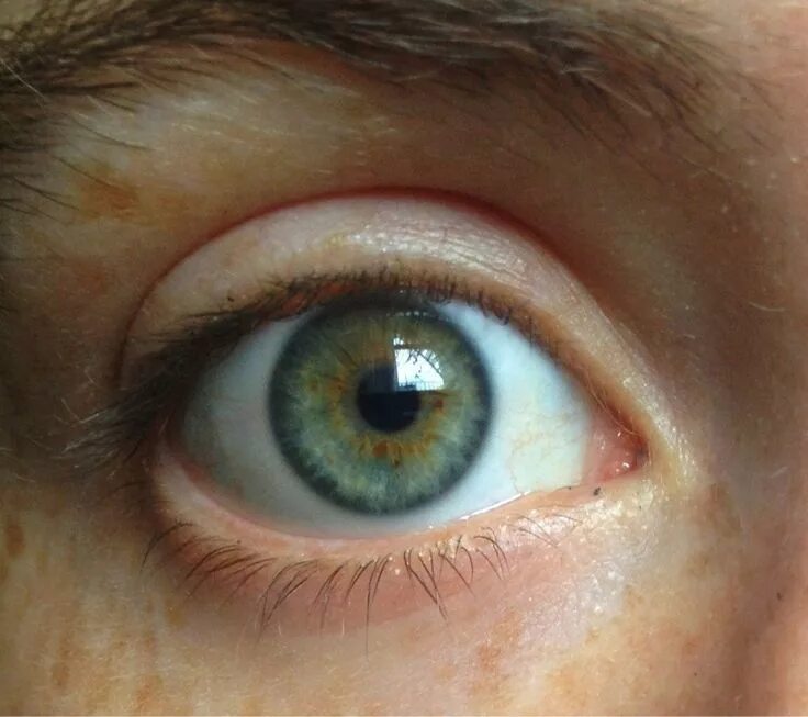 "♡ yellow eyes ♡" - image created in Shedevrum