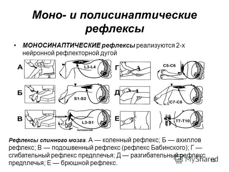 Ахиллов рефлекс Рецептор. Схема рефлекторной дуги ахиллова рефлекса звенья. Ахиллов рефлекс рефлекторная. Схема рефлекторной дуги ахиллова.