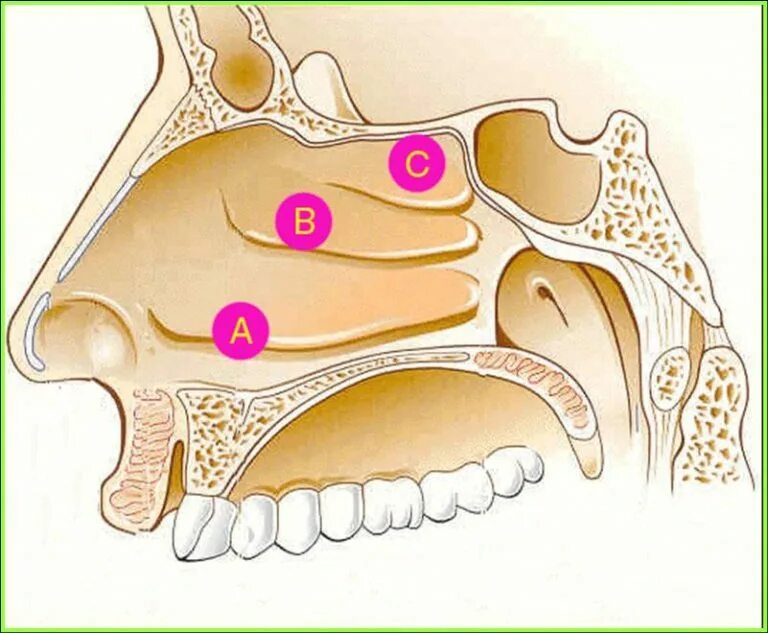 Подслизистой вазотомии нижних раковин. Раковины носовые анатомия вазомоторный ринит. Анатомия полости носа нижние носовые раковины. Конхотомия носовых раковин. Конхотомия средней носовой раковины.