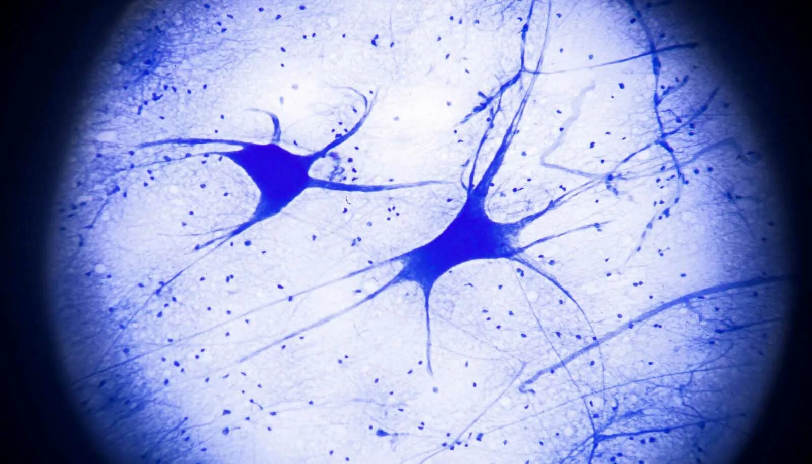 Нейрон гистология препарат. Нейрон микрофотография гистология. Клетки нейронов гистология. Нервные клетки под микроскопом гистология. Умершие клетки мозга