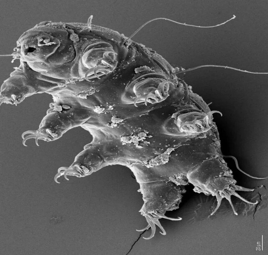 Бактерии в слюне. Бактерия тихоходка. Тихоходка под микроскопом. Микроб тихоходка. Тихоходка в микроскопе.