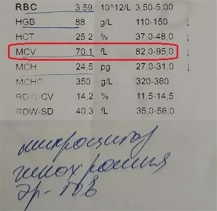 Микроцитоз в общем анализе что это. Микроцитоз в общем анализе что это