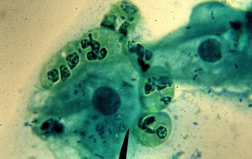 Mycoplasma genitalium микроскопия. Микоплазма гениталиум под микроскопом. Микоплазмоз под микроскопом. Микоплазмы возбудители.