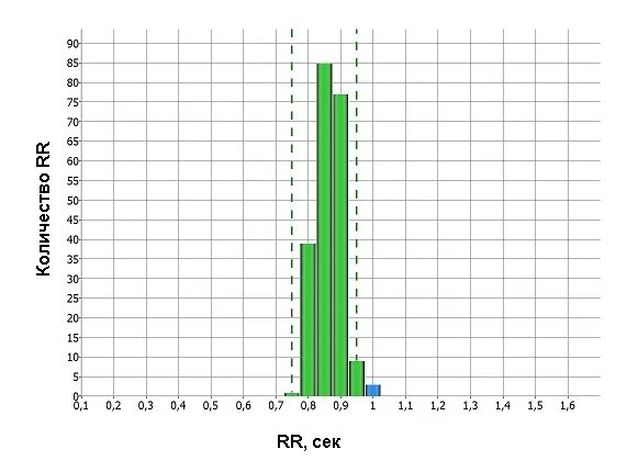 Гистограмма фото. Гистограмма результатов измерений. Гистограмма пульса. Гистограмма пульса. Анализ гистограммы распределения.