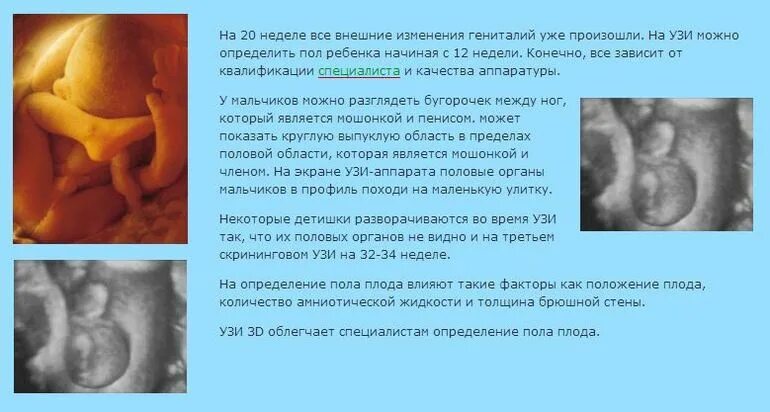 Можно ли на 16 неделе узнать пол. На каком сроке можно определить пол ребенка. УЗИ определение пола. На какой неделе можно определить пол ребенка. На какой неделе беременности можно определить пол ребенка.