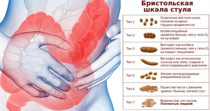 Жжение после опорожнения. Нарушение стула. Нарушение стула диарея. Причины расстройства стула у взрослых.