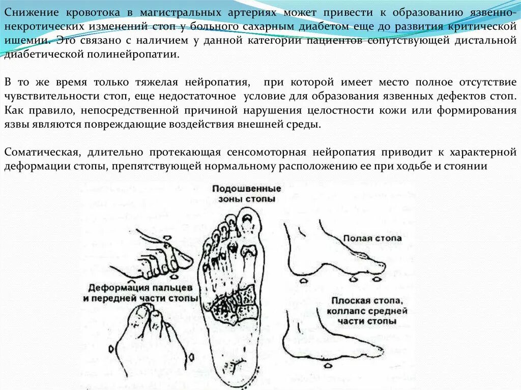 Диагноз болей в стопе. Нейропатическая диабетическая стопа. Схема лечения при диабетической стопе. Стопа при сахарном диабете. Диабетическая стопа начальная стадия.