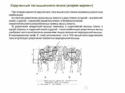 Таза лечение