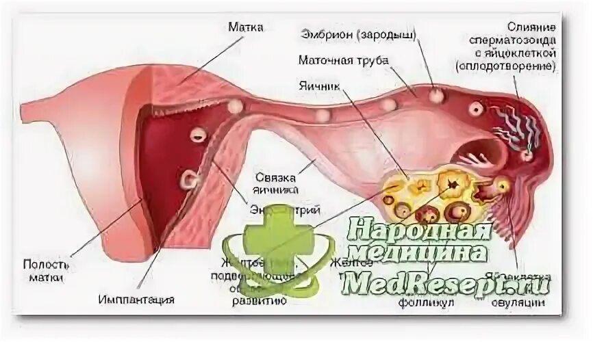 Латинское название яичников. Сбой гормонального фона.