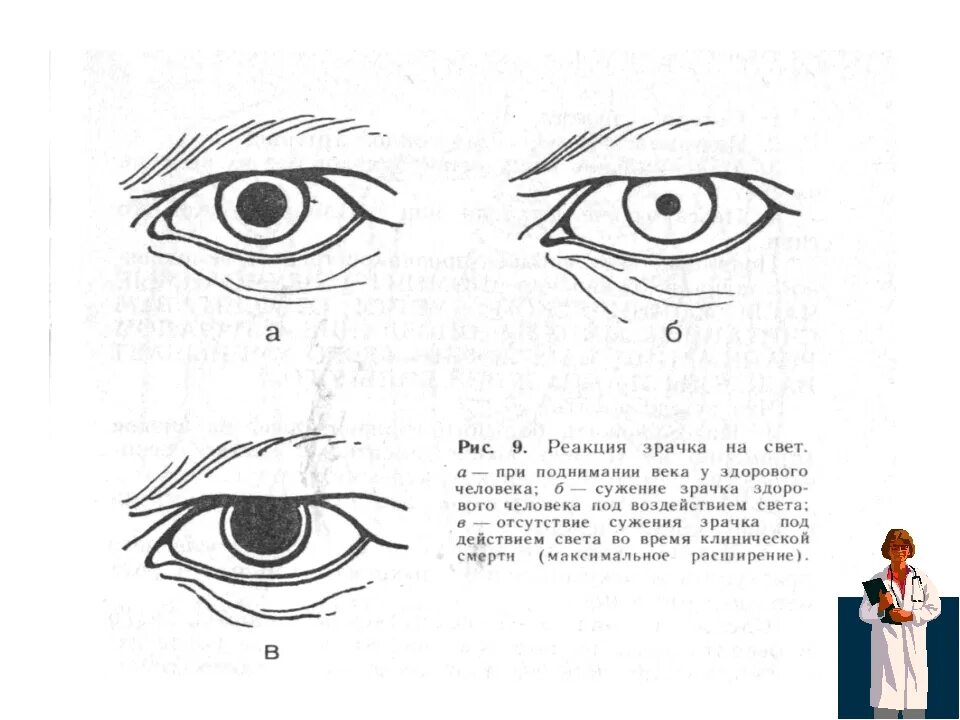 Признак Белоглазова феномен кошачьего глаза. Реакция зрачков на свет при клинической смерти. Зрачки при клинической смерти.