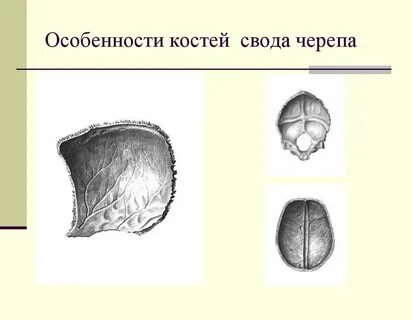 Свод черепа кости