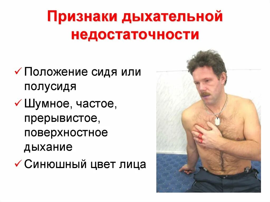 Угнетение дыхания симптомы. Острая дыхательная недостаточность симптомы. признаки дыхательной недостаточности. дыхательная недостаточность симптомы. дыхательная недостаточность клиника.