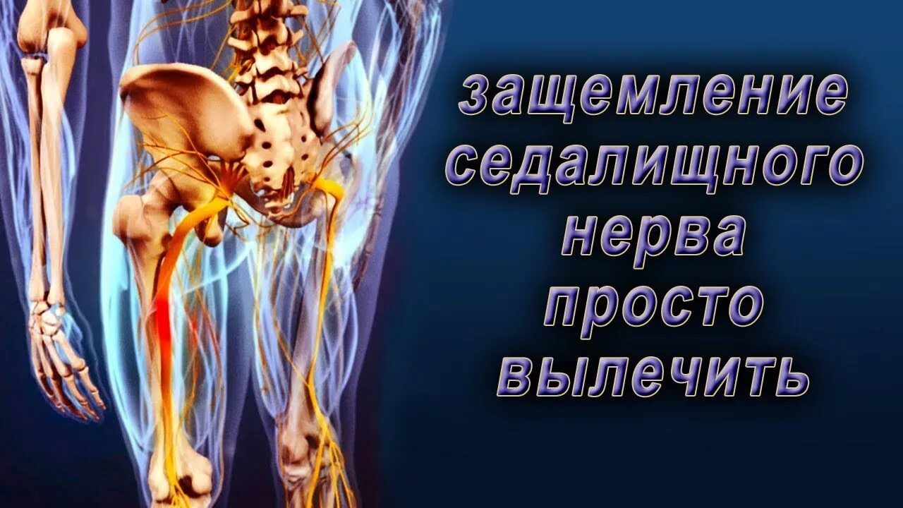 Сидальческий нерв лечение у мужчин. Седалищный нерв остеопатия. Доктор Демченко седалищный нерв. Воспаление седалищного нерва. Защемление седалищного нерва.