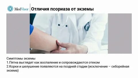 Характерные признаки экземы
