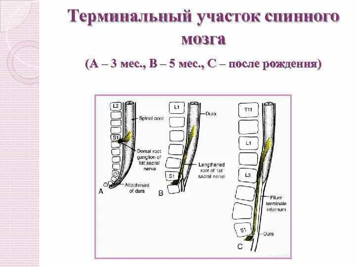 Участки спинного мозга. Терминальная нить спинного мозга. синдром терминальной нити спинного мозга. фиксированная нить спинного мозга. фиксация терминальной нити спинного мозга.