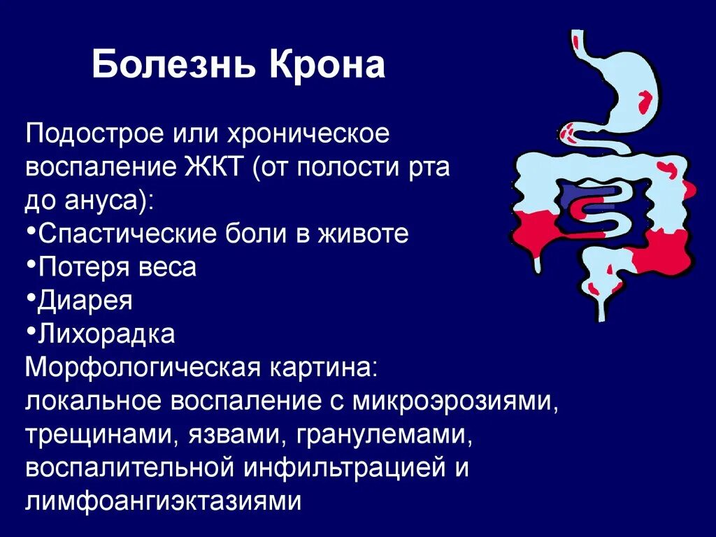 Болезнь крона лечение у взрослых кишечника. Патология кишечника презентация.