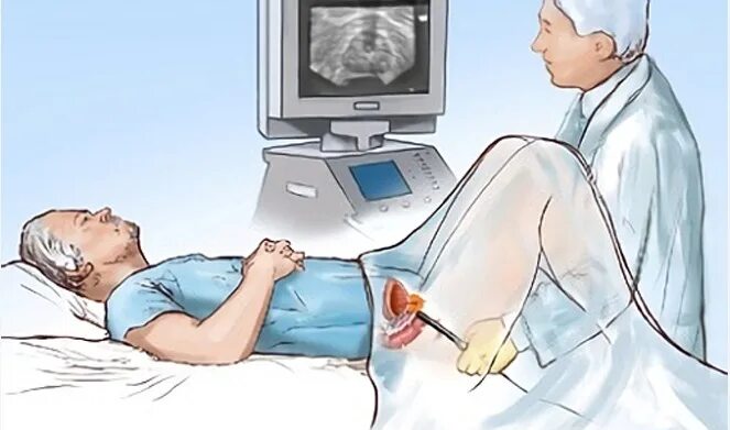 Узи простаты ректально. Ректальное ультразвуковое исследование предстательной железы. Трансректальное УЗИ предстательной железы. УЗИ трузи предстательной железы. Трансперинеальная биопсия.