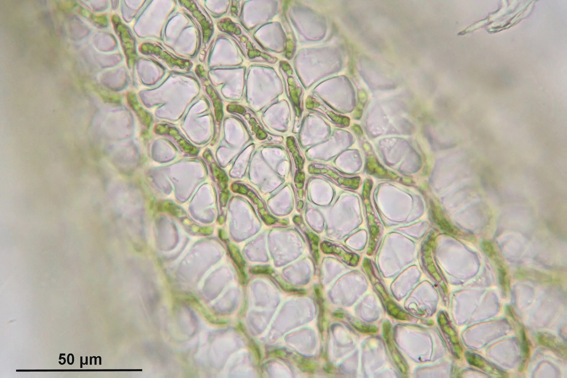 Водоносные клетки в листьях имеет. Аэренхима сфагнума. Гиалиновые клетки сфагнума. Клетки сфагнума под микроскопом. Сфагнум хлорелла.