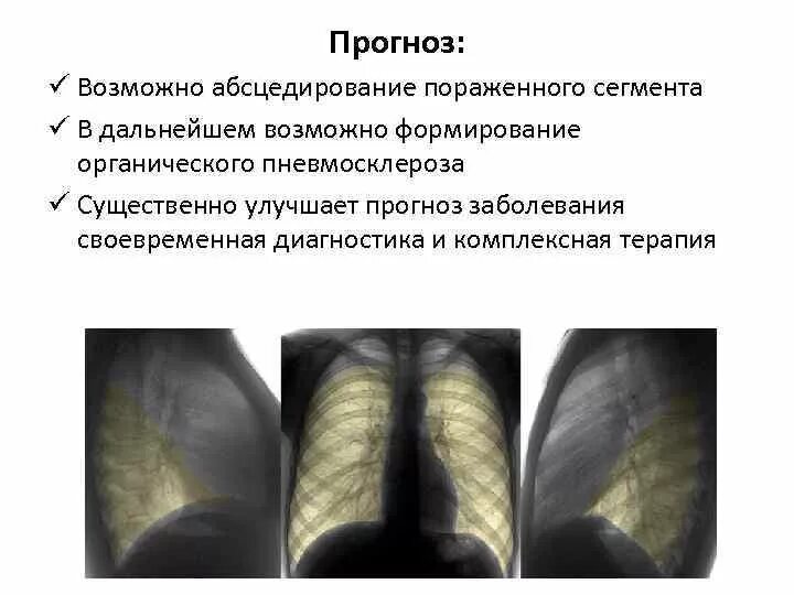 Диффузный пневмосклероз легких что это рак. Пневмосклероз рентген описание. Пневмосклероз клинические проявления. Диффузный пневмосклероз рентген.