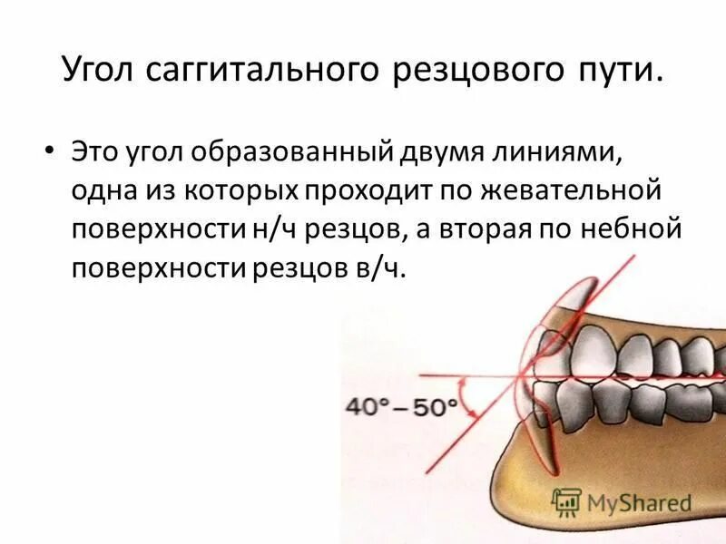 Угол сагиттального резцового пути. Угол сагиттального резцового пути