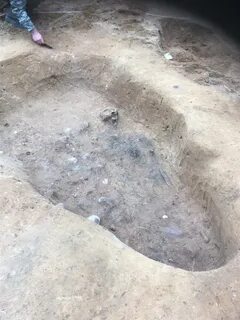 Кости сгорают