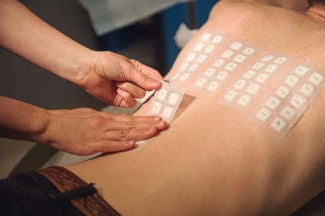 Тест на аллергию у ребенка. Скарификационные аллергопробы. Аллергические пробы на руке. Скарификационные кожно-аллергические пробы. Скарификационные кожные пробы.